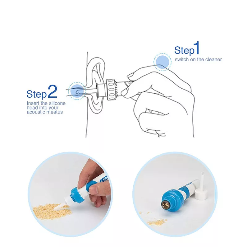 GentleSafe Ear Wax Vacuum Cleaner