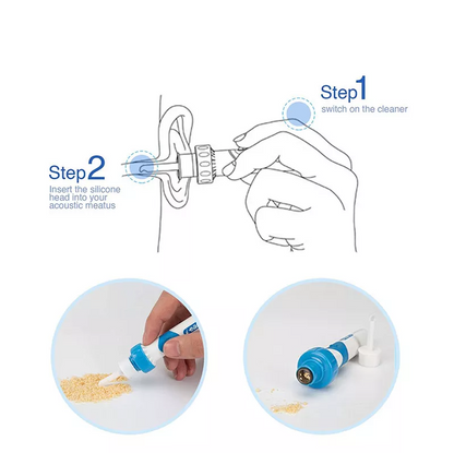 GentleSafe Ear Wax Vacuum Cleaner